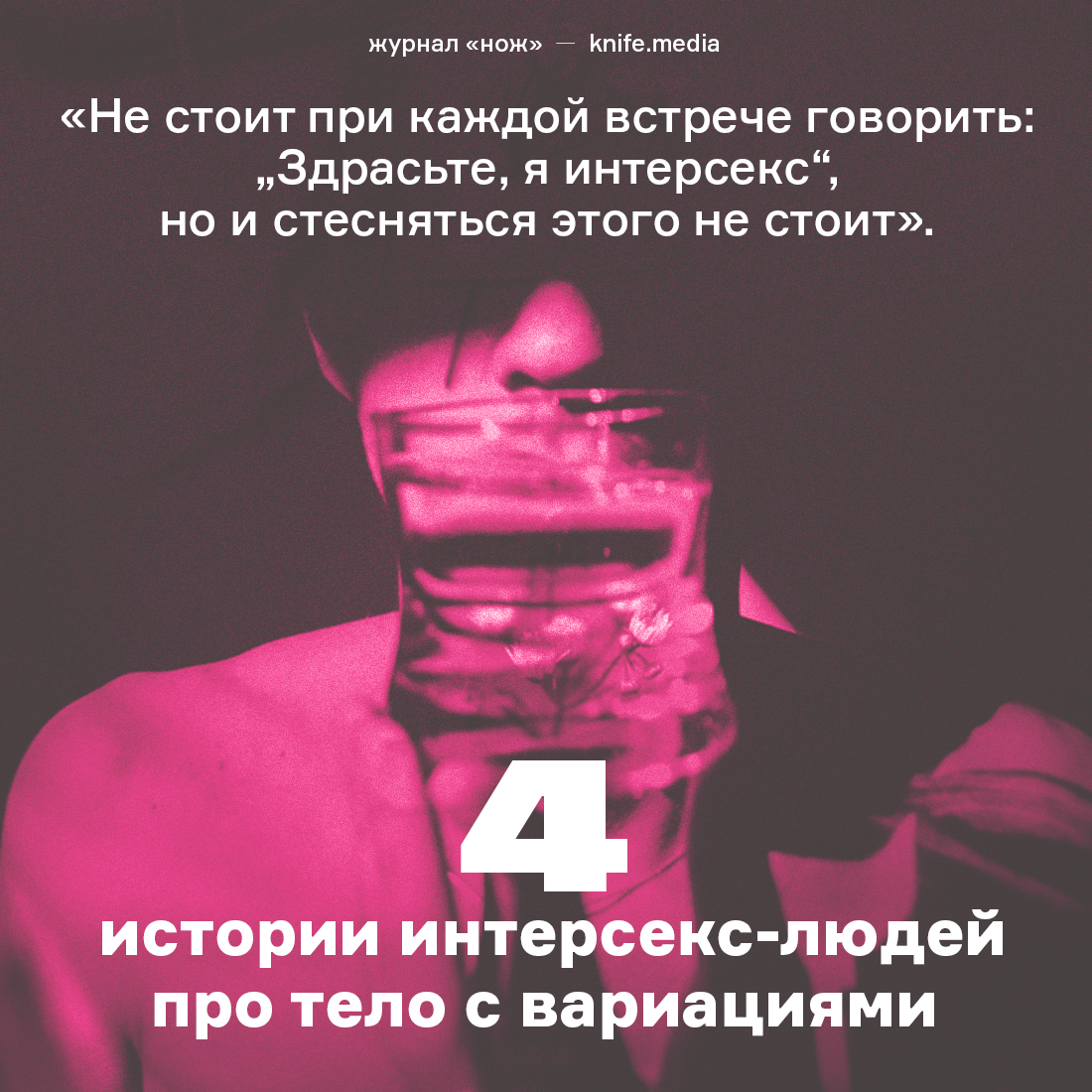 pchelamedia's tweet photo. Что писал об интерсекс-людях Пушкин, чем опасны операции по коррекции пола, с какими трудностями сталкиваются обладатели интерсекс-вариаций и какие плюсы они находят в своем положении?

https://t.co/9Iht0nL3Ms https://t.co/7Fj4hQQDgV