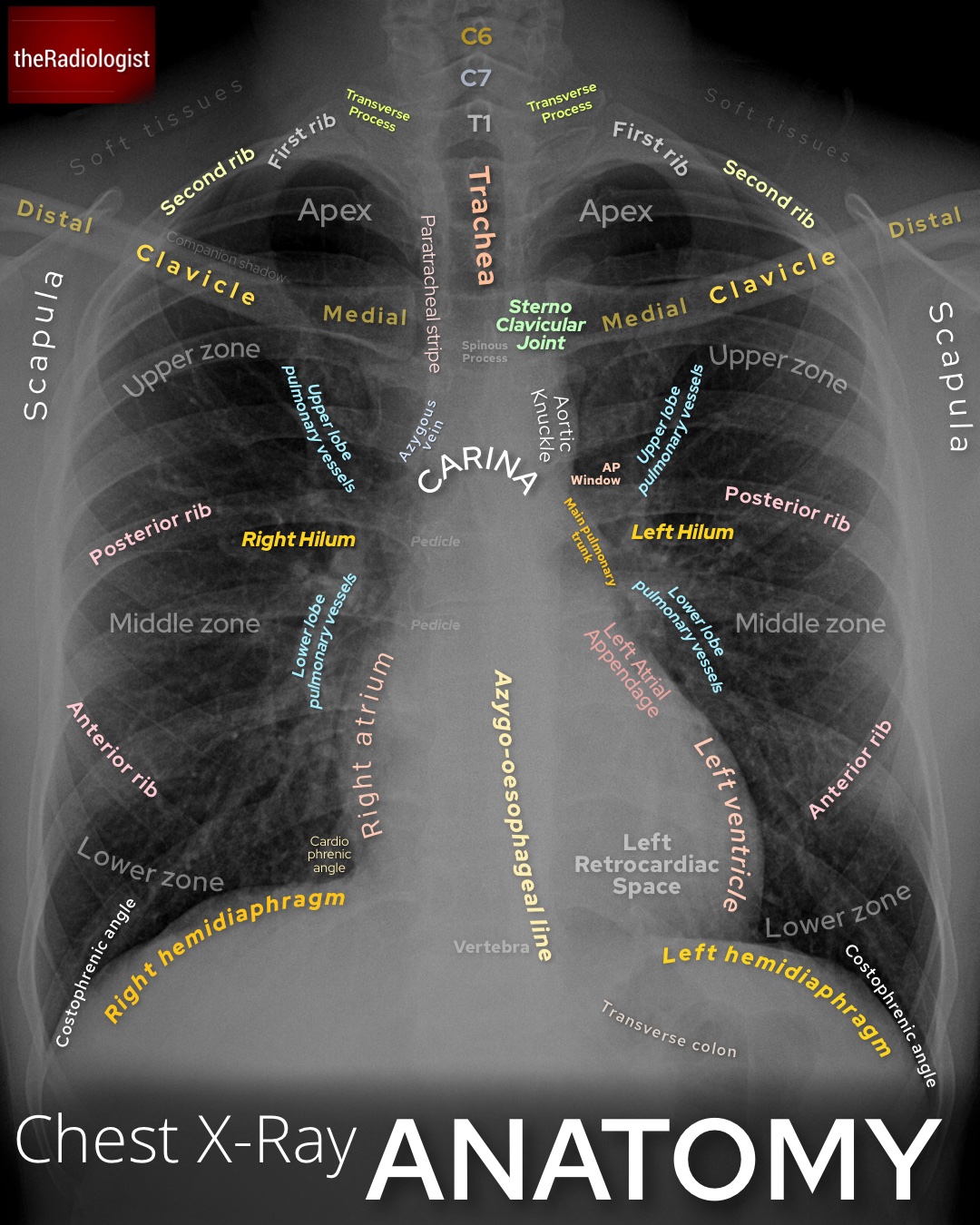theRadiologist on Twitter "Chest XRay Anatomy https//t.co/2OYPwKjpH4