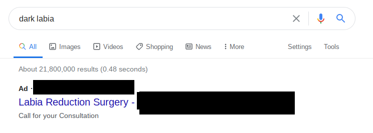 Let us turn now to colour. A lot of people worry about the colour of their labia, and it's normal to have darker labia... just like it's normal that your face-lips are darker than the rest of your face. But if you google that, you get labiaplasty ads.
