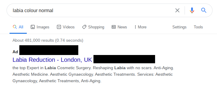 And if you're asking about normal colour of labia, you'll be getting - we're sure you're sensing a theme by now - labiaplasty ads.