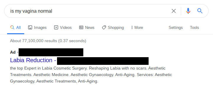 Even googling about if your vagina is normal returns labiaplasty ads.