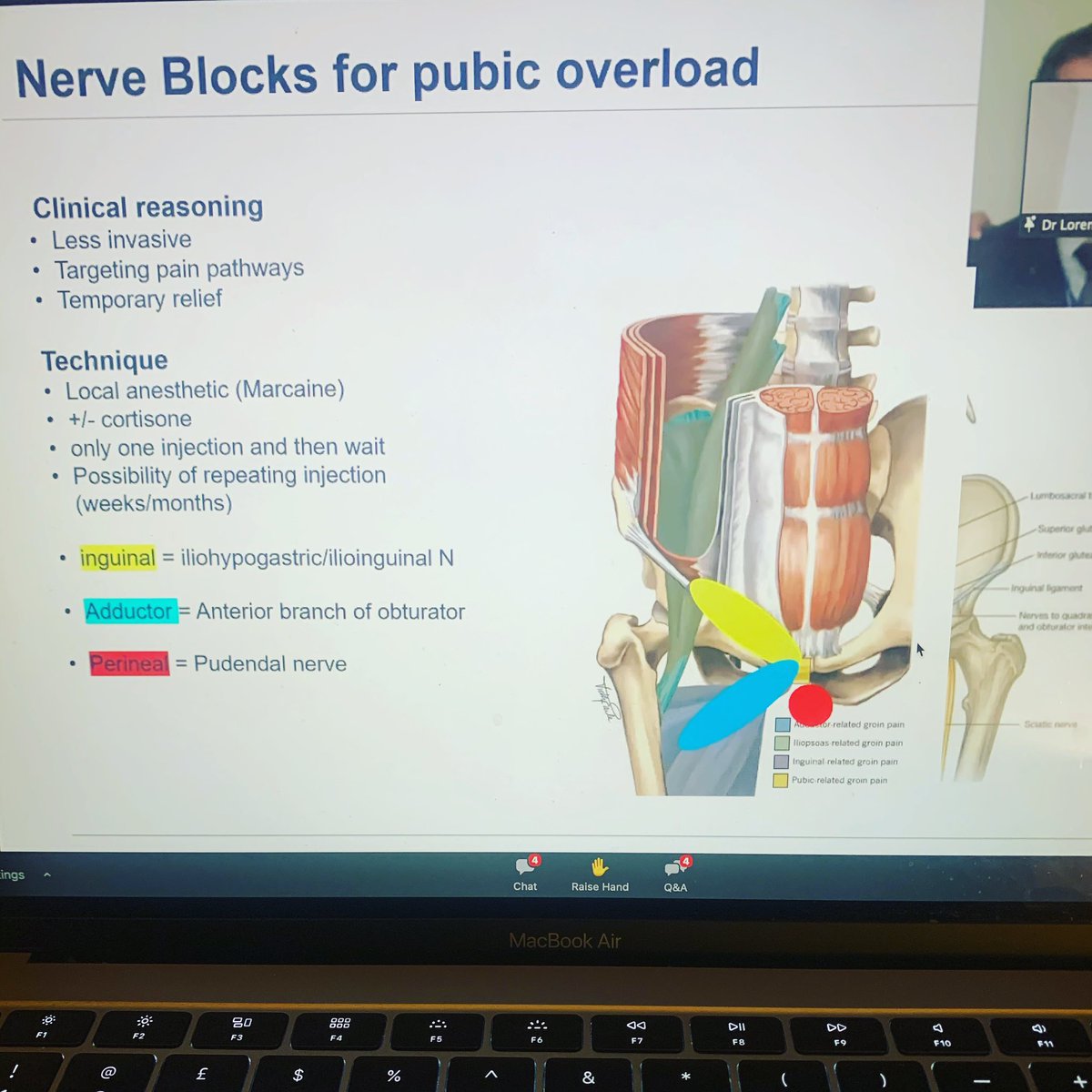 Thanks @lorenzo_masci and @one_welbeck for another great webinar on the sporting hip and groin!
#pubicoverload #hiparthroscopy #injectiontherapy #hernia #endometriosis #pelvicimaging #bedfordphysio #londonphysio #onlinephysio