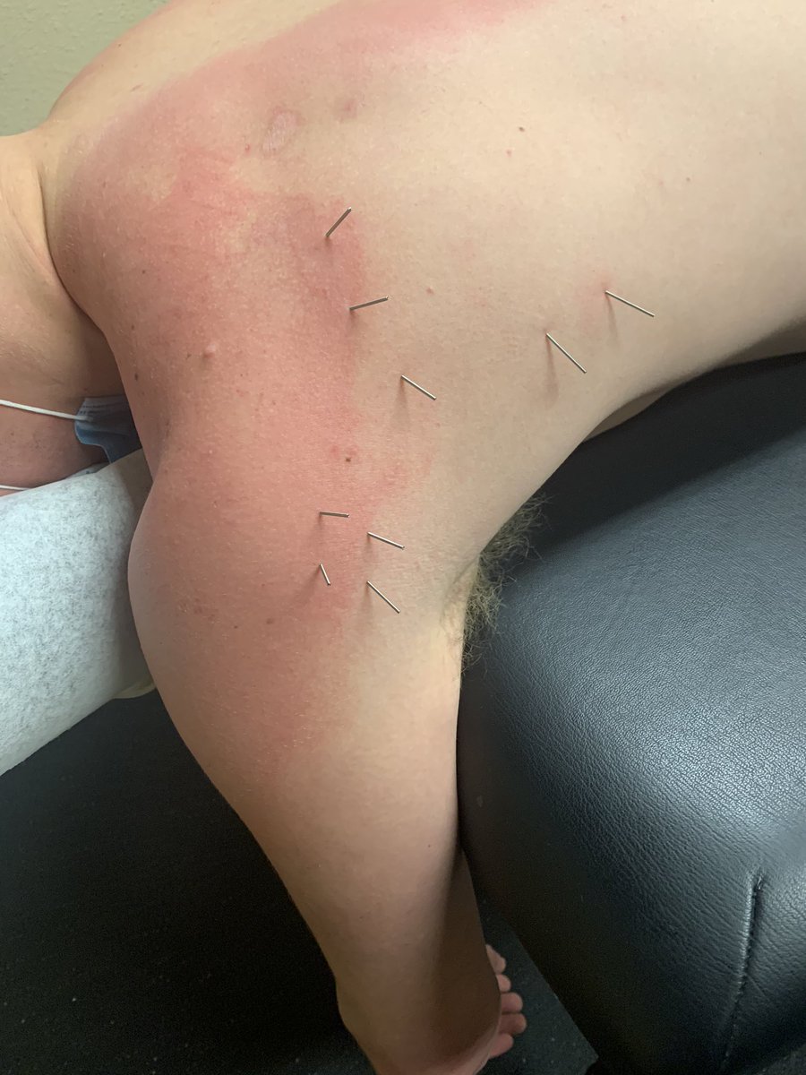 _PerformanceLab's tweet image. Return to play your way: propelhp.com/blog/ 

#hockey #paintoperformance #sportrehab #coaching #returntoplay #kgb