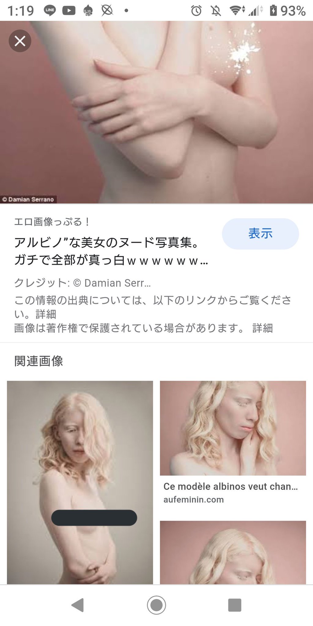 アルビノ　乳首  / X