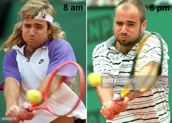 atman_ci's tweet photo. The slight difference between how you look at the start of the day and how you look at the end after..many powerful forehands of prostate bio, heaviest backhands of specimens, ACEs+smashes of breast/lung bio and volleys of Thyroid FNAs...#ILoveThisGame #PathFun #PathTwitterFamily https://t.co/aecpdQPH0L