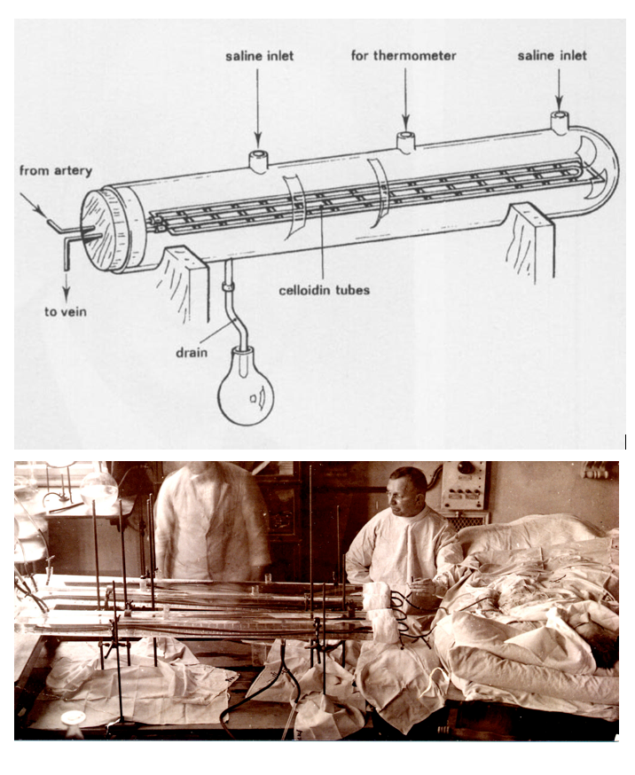 Georg Haas (1886-1971) was a German medical #doctor who performed the first human #hemodialysis #treatment (october 1924). The procedure lasted only 15 minutes, and hirudin served as the anticoagulant. 
#histmed #medicine #science #historiamedica #medizin #medicine #Kidney