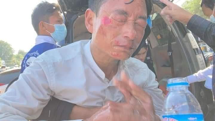 PoliceAndArmyDispersedTheProtestersWithin15minByUsingWaterCannonTrucksInNayPyiTaw,whereProtestAgainstMilitaryDictatorship.More than10peopleAreInjuredByWaterGun.PoliceAndMilitaryStartShootingWithRealGun.AGirlFaintedInEmergencyRoomAndABoyInTheOperationRoom. 
#WhatsHappeningInBurma