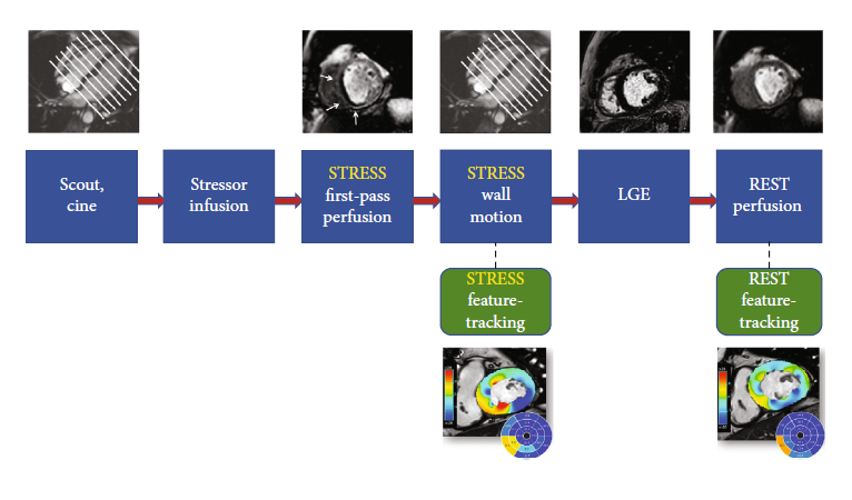 Monzino Cardiovascular Imaging Department (@monzinoimaging) on Twitter photo ♨ ♨♨ Hot off the press! ♨♨♨
Stress CMR 🧲 in Known or Suspected CAD: Diagnostic and Prognostic Role
pubmed.ncbi.nlm.nih.gov/33511208/
Francesca Baessato <a href="/MarcoGuglielmo/">Marco Guglielmo MD, FEACVI, FSCCT</a> <a href="/GiuseppeMuscog/">Giuseppe Muscogiuri</a> <a href="/AndreBaggi/">Andrea Baggiano</a> <a href="/gpontone1/">Gianluca Pontone</a> <a href="/LaFusini/">Laura Fusini</a>
#cardiovascularimaging
#whyCMR
<a href="/CCMonzino/">C. C. Monzino</a> ♨ ♨♨ Hot off the press! ♨♨♨
Stress CMR 🧲 in Known or Suspected CAD: Diagnostic and Prognostic Role
pubmed.ncbi.nlm.nih.gov/33511208/
Francesca Baessato <a href="/MarcoGuglielmo/">Marco Guglielmo MD, FEACVI, FSCCT</a> <a href="/GiuseppeMuscog/">Giuseppe Muscogiuri</a> <a href="/AndreBaggi/">Andrea Baggiano</a> <a href="/gpontone1/">Gianluca Pontone</a> <a href="/LaFusini/">Laura Fusini</a>
#cardiovascularimaging
#whyCMR
<a href="/CCMonzino/">C. C. Monzino</a>