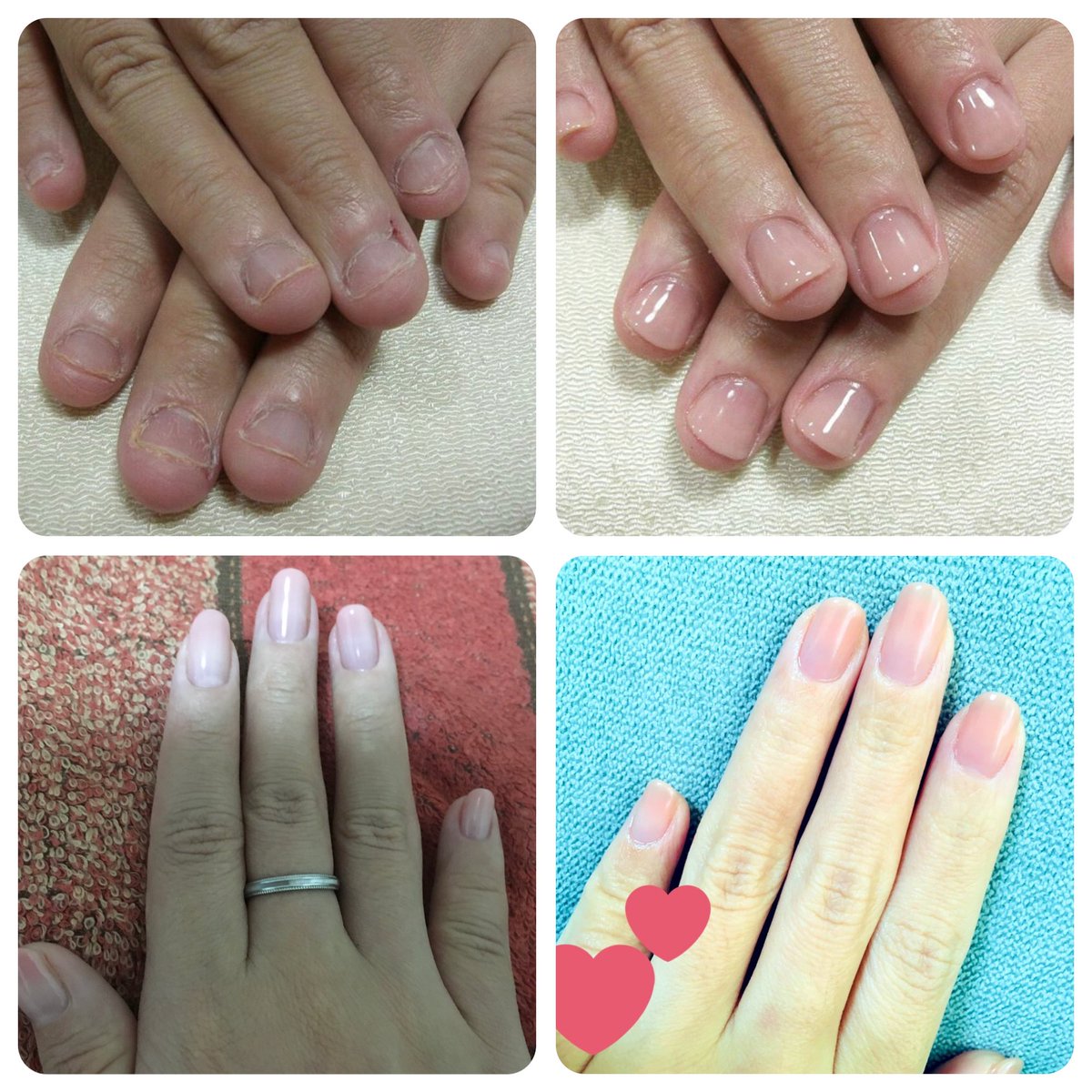 Para Gel パラジェル Paragel Twitter