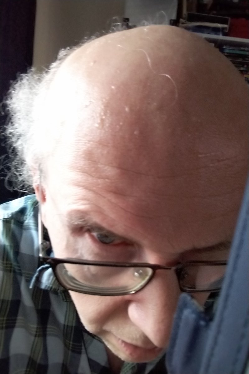 simonbrew's tweet image. Aches. #pewithjoe