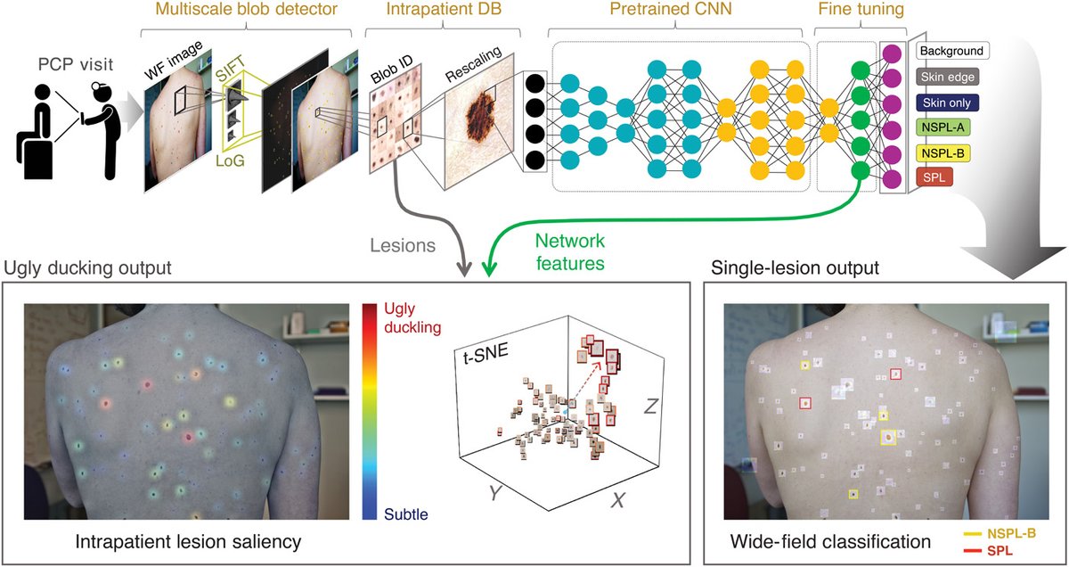 A neural network system that analyzes photographs can rank and distinguish suspicious, potentially precancerous skin lesions, which can turn into the deadly skin malignancy melanoma if not caught and removed early. Learn more in <a href="/ScienceTM/">Science Translational Medicine</a>: ($) fcld.ly/rb4zdxv