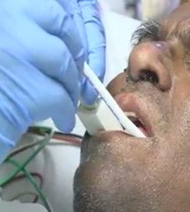 OralAccessStudy's tweet photo. Announcing a NEW DELPHI STUDY on outcomes associated with devices to improve oral access for patients treated with breathing tubes. Please follow and share! #Research #ICU #Surgery #DentalCare #OralHealth https://t.co/22JmS5OR4a