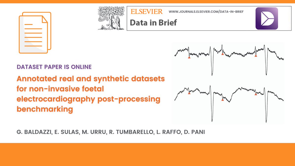 Unica Eolab (@unicaeolab) on Twitter photo A new annotated dataset of real and synthetic non-invasive #fECG signals has been published. This #dataset could be useful for benchmarking of post-processing algorithms but also for testing #noninvasivefECG extraction algorithms.
📑 tinyurl.com/14h7xl6l
<a href="/sciencedirect/">Elsevier | ScienceDirect</a> A new annotated dataset of real and synthetic non-invasive #fECG signals has been published. This #dataset could be useful for benchmarking of post-processing algorithms but also for testing #noninvasivefECG extraction algorithms.
📑 tinyurl.com/14h7xl6l
<a href="/sciencedirect/">Elsevier | ScienceDirect</a>