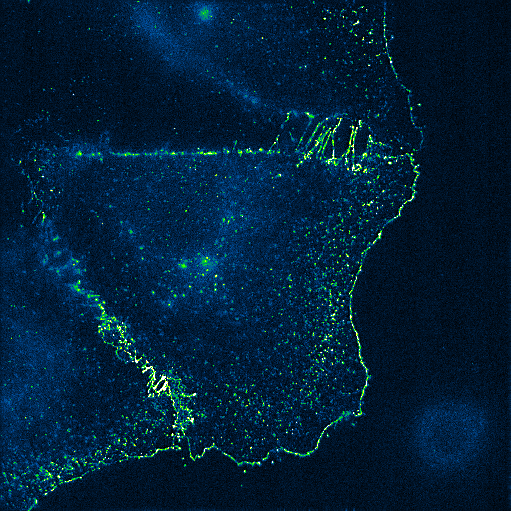 MedChemBiol's tweet photo. Imaging CD133 in colon carcinoma cells. Getting such wonderful images using wide-field fluorescence microscopy.    #microscopy #CD133 #carcinoma #fluorescence #MondayMotivation #Prague #UCT #Science https://t.co/LMhAjSEcOb