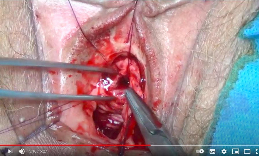 Benoît Peyronnet tweet media