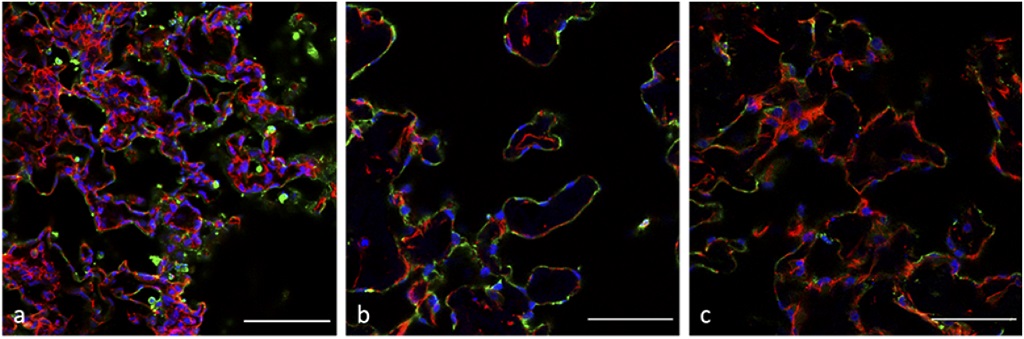 OpticaPubsGroup's tweet image. Via #OSA_BOEx: Three-dimensional characterization of collagen remodeling in cell-seeded collagen scaffolds via polarization second harmonic generation ow.ly/K0br50DBZZH #NonlinearMicroscopy @Stratakis_Emm