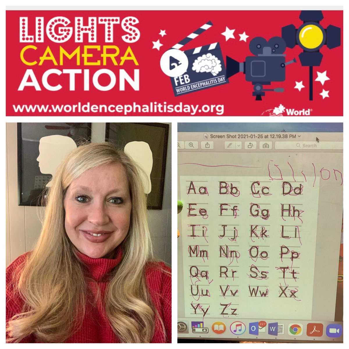 Whitney DuBroc (@whitneydubroc) on Twitter photo I’m wearing red today for World Encephalitis Day because of a very special kiddo! Dillon- it’s a joy to watch you grow and an honor to bring awareness today! #Red4WED @RonnieRo37 <a href="/TriciaBoughton/">Tricia Boughton</a> I’m wearing red today for World Encephalitis Day because of a very special kiddo! Dillon- it’s a joy to watch you grow and an honor to bring awareness today! #Red4WED @RonnieRo37 <a href="/TriciaBoughton/">Tricia Boughton</a>