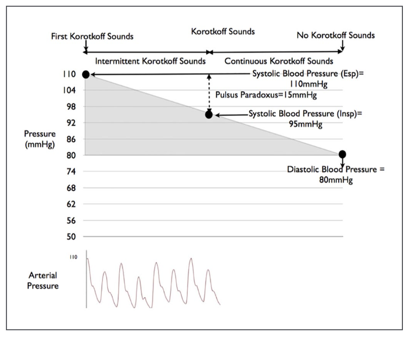 PabloJ's tweet photo. Cardiac tamponade: an educational review @ACVCPresident @rafavidalperez #ESCACVC @ImazioMassimo @krychtiukmd @AgudosSEC
https://t.co/bD0bKEFIpN https://t.co/6vTeUF7Jzd