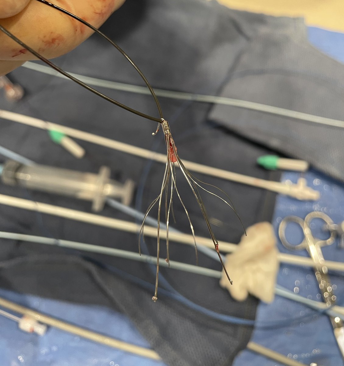 pparmetIR's tweet photo. 70 yo F referred for IVC filter retrieval- Celect placed 11 mo prior at OSH.

Tilted filter w/ embedded hook?  No problem for #IRad.  Modified loop snare technique to engage apical cap for a successful #filterout. #GTFO @SIRspecialists @Synergyrad @SIR_ECS @SIRRFS https://t.co/5xEhg5hJCa