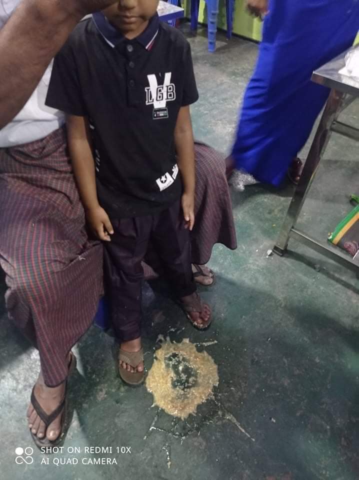 takhon_intel's tweet photo. Military shot even kid tonight!!!!
Where is Justice for us?

tw//blood

#WhatsHappeningInMyanmar https://t.co/xvFKljlOVh