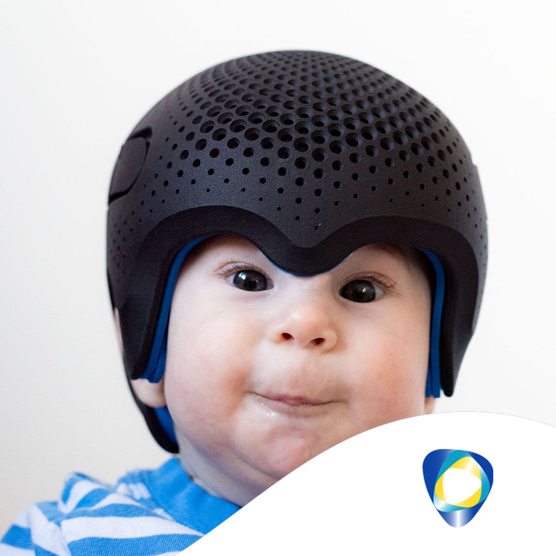 technoinmotion's tweet photo. Meet Alexander, who started his journey at Technology in Motion recently with a form of crainosynotosis called metopic synostosis/trigonocephaly.

To find more stores like Alexander’s, visit our website below:

https://t.co/UI8B2wNYmx

#technologyinmotion #timbandair https://t.co/WMo1cKVkvw