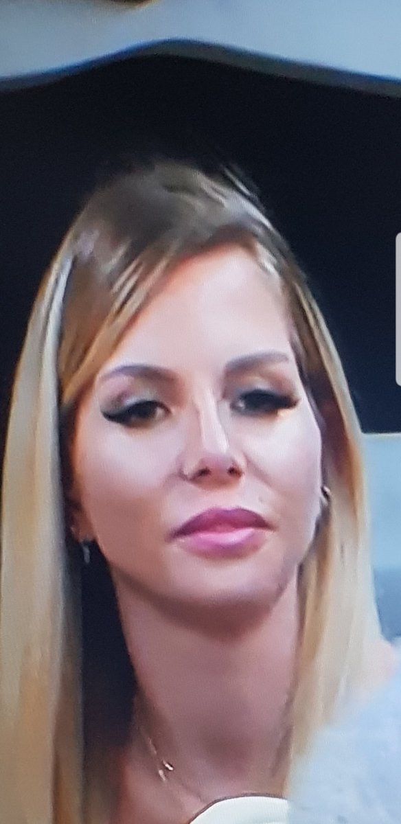 meteque_fan88's tweet photo. Le but de la chirurgie c est de  t'embellir nan ?
#lesmarseillaisadubai 
#LMAD https://t.co/Agj3nVPmxE