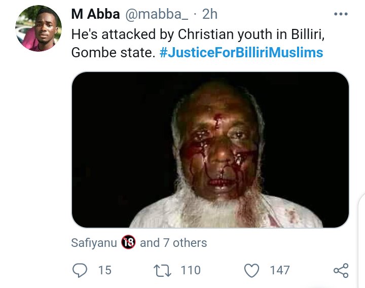 omokehinde___'s tweet photo. I'm sure you must have seen tweets from some handles claiming that this man was attacked in Billiri. This is FALSE!

This man is an Indian and the incident that resulted to these injuries happened in India. So please ignore them.
#Justice4Billiri https://t.co/pRFvttLWbc
