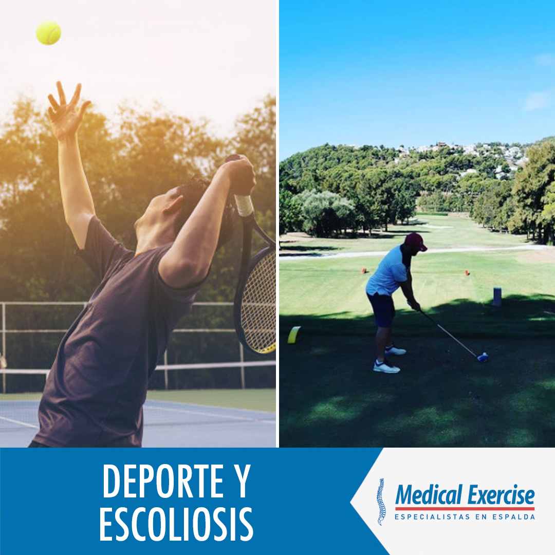 Medical_EX's tweet photo. En deportes como el golf o el tenis, por ejemplo, estos movimientos son especialmente importantes, pues en cada golpe se realizan dichos movimientos de rotación y flexión, en mayor o menor grado.
Padecer escoliosis puede empeorar la condición si los practicamos frecuentemente. https://t.co/JzoQwFK2Ap
