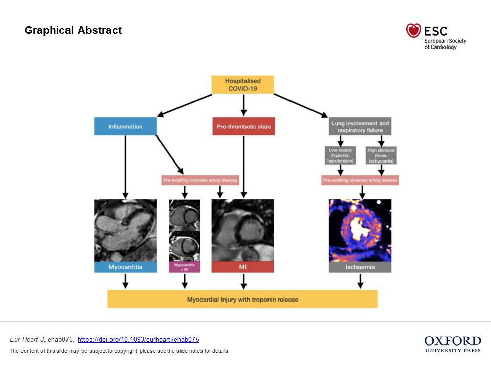 ehj_ed's tweet image. Covid 19 and the heart: still much to understand. Read on the EHJ ow.ly/p93u50DHiOB