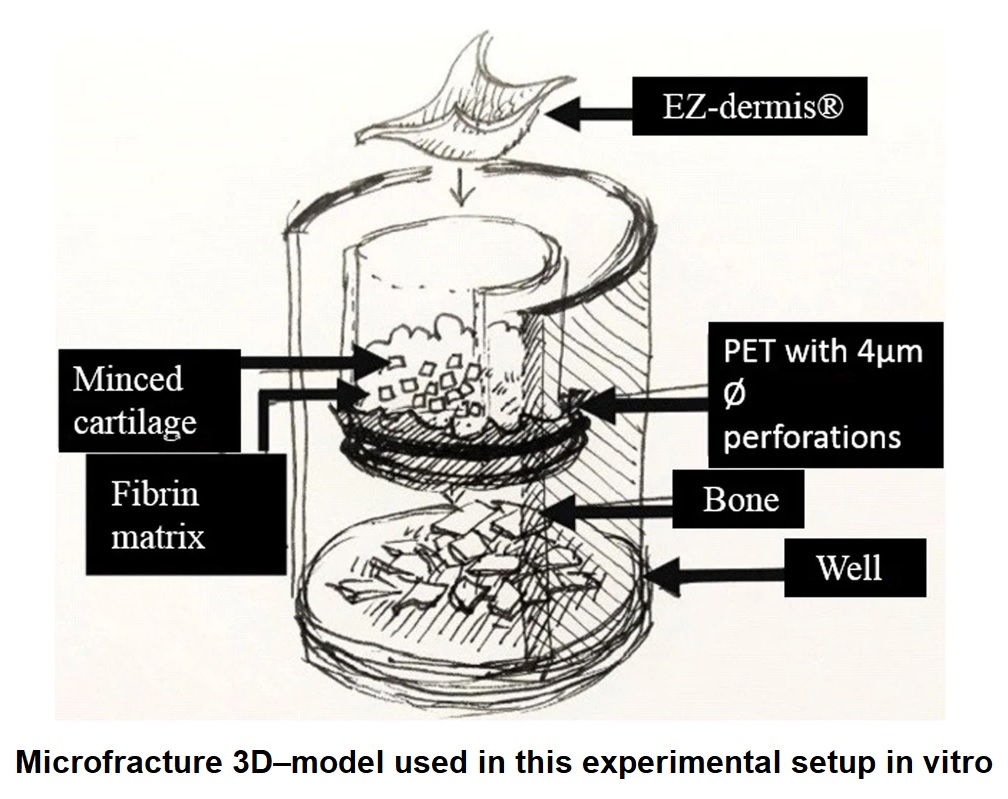 When healthy cartilage is damaged, it is fiendishly  difficult to repair it. 
This new paper by Andjelkov et al. presents a new  3-D in-vitro cartilage model to assess new therapies for chondral lesions.
Read the full paper at jeo-esska.springeropen.com/articles/10.11…