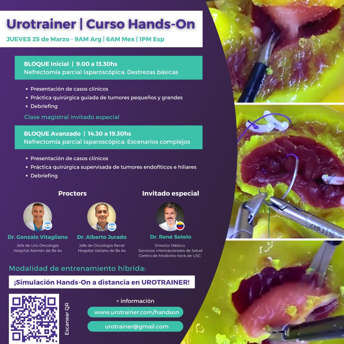 Gonzalo Vitagliano (@drvitagliano) on Twitter photo THOUGHT hands on courses were over during pandemia ?
Well… THINK AGAIN !!! And SAVE THE DATE - UROTRAINER VIRTUAL HANDS-ON <a href="/urotrainer/">Urotrainer | Urology Surgical Simulation</a> <a href="/amjurado67/">Alberto Jurado</a> <a href="/DoctorSotelo/">Dr. René Sotelo</a> THOUGHT hands on courses were over during pandemia ?
Well… THINK AGAIN !!! And SAVE THE DATE - UROTRAINER VIRTUAL HANDS-ON <a href="/urotrainer/">Urotrainer | Urology Surgical Simulation</a> <a href="/amjurado67/">Alberto Jurado</a> <a href="/DoctorSotelo/">Dr. René Sotelo</a>