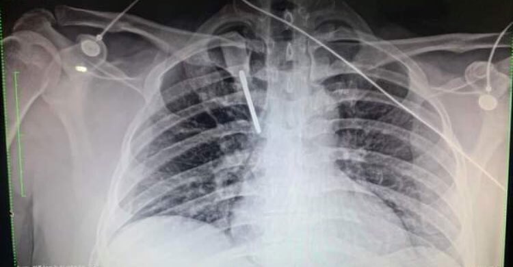 Asaltaron a un residente de pediatria afuera de mi antigua sede (UMAE 25) en Monterrey, mientras se encontraba de guardia. No se. Estoy indignado. No podemos trabajar así.
