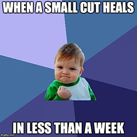 Sweetdiabetic2's tweet photo. Yaaasss! I can stop being paranoid about the wound healing. 😅

#sweetdiabetic #diabetic #diabeticlife #diabeticfriendly #type2diabetic #diabetics #diabeticproblems #diabeticgirl #diabetictype2 #type2 #hba1c #bloodusgar #glucose https://t.co/Zb6z2Jvibw