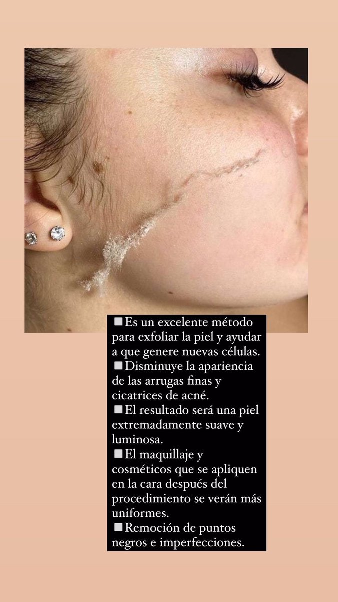 Vicky_rroige's tweet photo. Buenas tardes chiques! Como todos dicen twitter es un servicio y estoy empezando a trabajar por mi cuenta, soy Lic. En kinesiología y Fisiatría dedicada a la estética! Si me pueden ayudar con un RT y encima me consultan me hacen un GRAN favor ♥️ https://t.co/qiW6t9qdDX