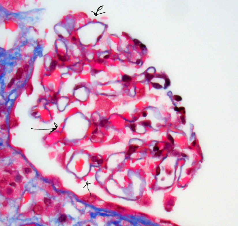 Jonathan Zuckerman MD PhD tweet media