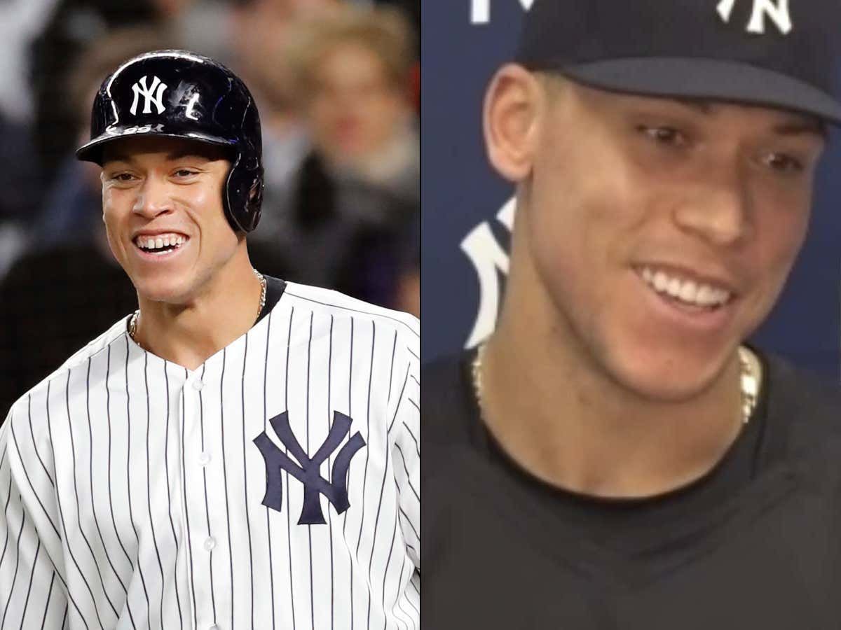 Aaron Judge all smiles after his chipped tooth is repaired - Newsday