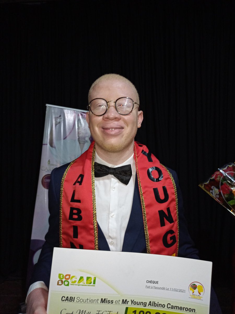 CRTV_web's tweet photo. Loïc Abondo, étudiant en Licence 2 à l'Ecole Supérieure des Sciences et Techniques de l'information (Esstic) est le nouveau @Mister Young Albino 2020. Il a été élu au terme de la finale qui s'est déroulée ce 11 février 2021 à Yaoundé.
#Cameroun
#Albinisme https://t.co/A96rwzPMjW