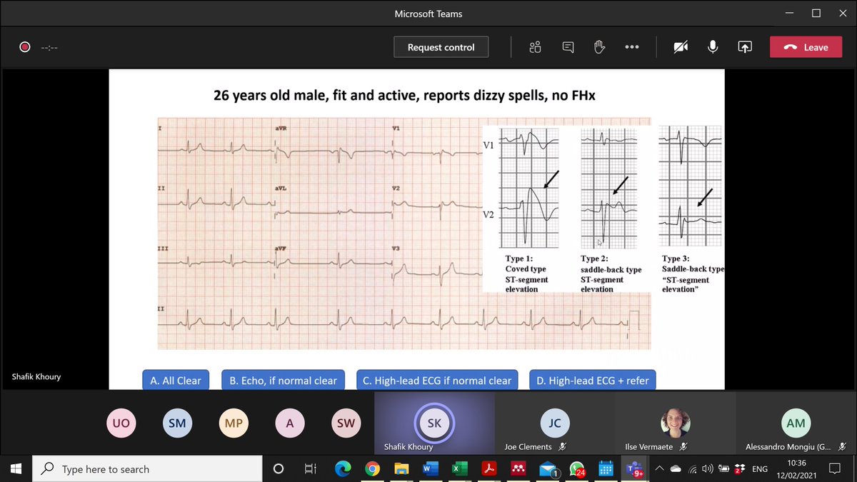 Dr <a href="/DrShafikKhoury/">Shafik Khoury</a> on the differential diagnosis between athlete's heart and Brugada syndrome. MsC in Sports Cardiology at <a href="/StGeorgesUni/">St George's, University of London (1752-2024)</a> <a href="/CRY_UK/">CRY</a> <a href="/SSharmacardio/">Sanjay Sharma</a> <a href="/MichaelPapadak2/">Prof Michael Papadakis</a> <a href="/escardio/">European Society of Cardiology</a>