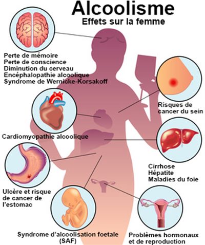 addict_act's tweet photo. Les maladies auxquelles vous vous exposez, lorsque vous consommez abusivement de l'alcool ⚠⚠⚠
Pour en savoir plus sur l'une de ces maladies, posez vos questions en commentaire.
#AddictAct #AvoidAlcoholAddiction https://t.co/Kw8vNG89u0