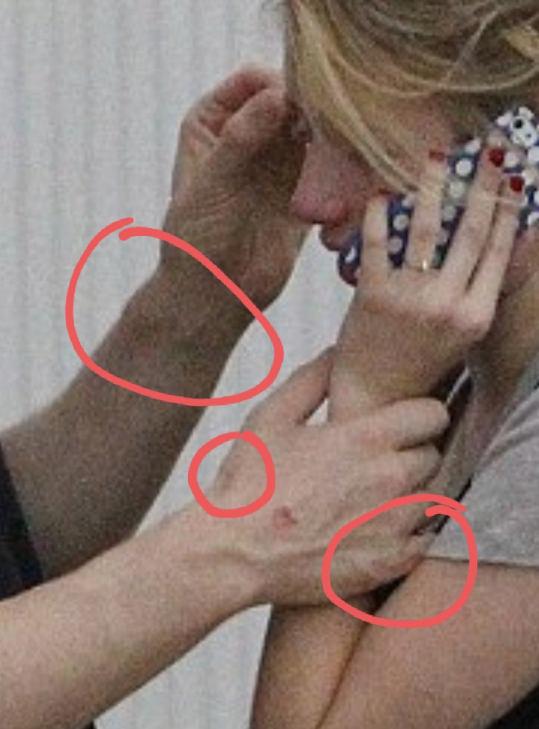 TattyLou7 on X: "Pining these photos of Evan Peters comforting his abuser Emma  Roberts while his face, wrists and hands were still covered in bruises and  bite marks, in case anyone forgets