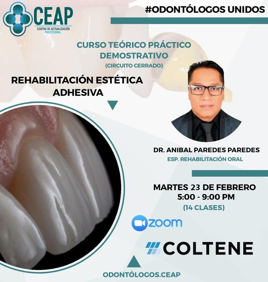 COLTENE PERU Y CEAP te invita a su próximo curso
Teórico - Interactivo y Demostrativo "REHABILITACIÓN ESTÉTICA ADHESIVA" - Dr. Anibal Paredes Paredes - Certificado Virtual de CEAP - Informes  bit.ly/3oIhtMT / whatsapp +51 968 555 266
#coltene #esteticadental #carillas