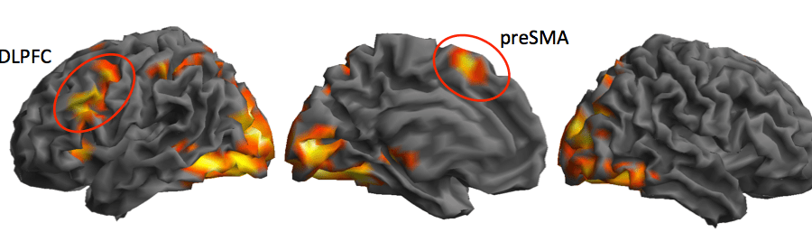 📢 NEW TEACHER RESEARCH! 📢

Neural and behavioural correlates of science reasoning during adolescence

by Jack White-Foy, <a href="/DulwichCollege/">Dulwich College</a> 

praxis-teacher-research.org/neural-and-beh…