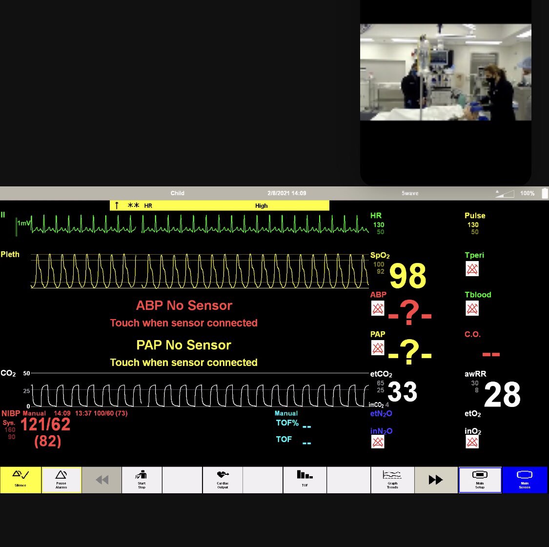 JHPedsAnes's tweet photo. Virtual #PedsAnes simulation with our fellows is as educational as in-person simulation thanks to @JHUSimCenter! @ACCMeducation @HopkinsACCM @HopkinsMedicine @HopkinsKids https://t.co/EZqyRdwESO