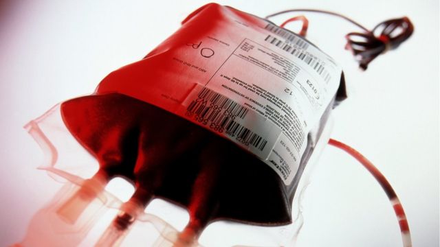 Se necesita donante de sangre urgente. 

Para cualquier colaboración favor comunicarse con la señora Lucia Paredes al teléfono (809) 853-7637. #NoticiasSIN