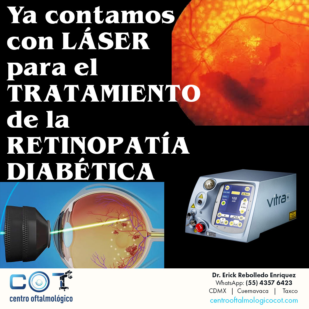 Más información: centrooftalmologicocot.com #CentroOftalmológicoCOT #OptometristaTaxco #OftalmologoGuerrero #CirugiasCataratasTaxco #OftalmologoCOT #LIO #LenteIntraocular #CirugiaCatarata