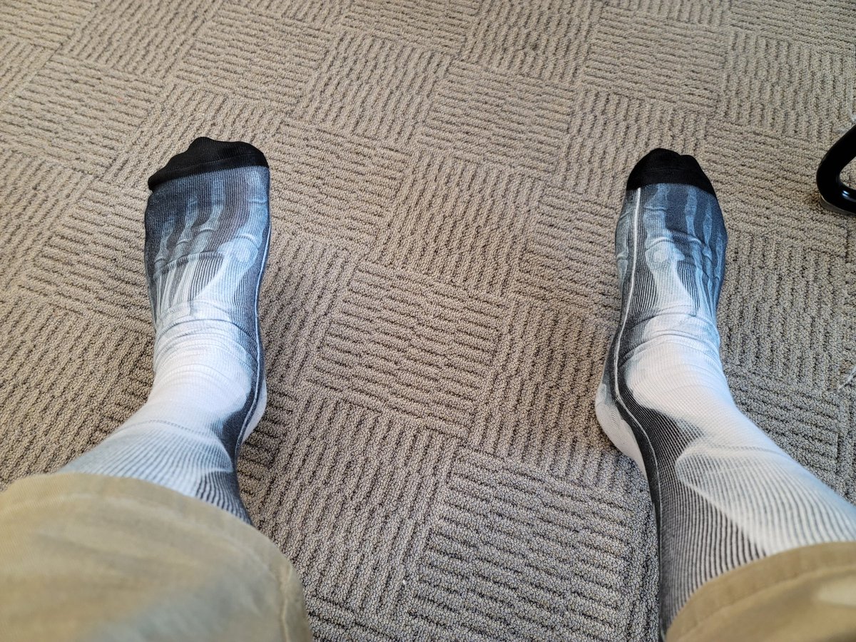 Coty Hill (@hill_coty) on Twitter photo No bones about it, it's crazy sock day! <a href="/JCDreamTeam/">Johnson City Call Center</a> #proud2bYoung #lifeatatt No bones about it, it's crazy sock day! <a href="/JCDreamTeam/">Johnson City Call Center</a> #proud2bYoung #lifeatatt