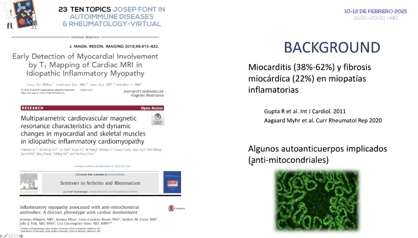 GEAS_SEMI's tweet photo. #Miocarditis intersticial ¿Una manifestación más del síndrome #antisintetasa? Dr. Selva  #23TenTopics #SEMITuit

El miocardio puede ser una diana en las patologías inflamatorias, a veces asociados a determinados anticuerpos (antimitocondriales) https://t.co/gM9pufEaHt