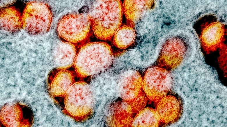 BREAKING | Mass COVID-19 outbreak due to coronavirus variant, N.L. back under Alert Level 5 lockdown

cbc.ca/1.5913042

#covid19nfld #covid19nfldlab