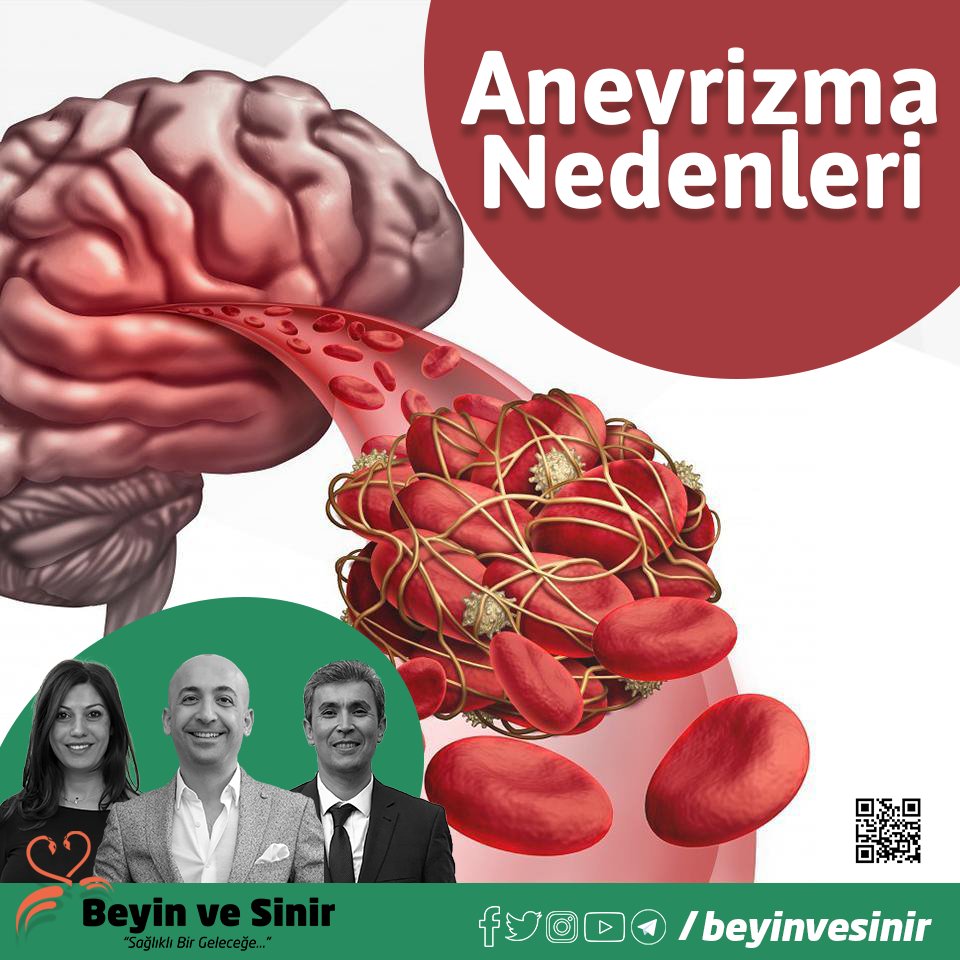 Anevrizma (Beyinde Baloncuk) nedenleri?

#Sigara kullanımı #YüksekTansiyon ve #Genetik yatkınlık #Anevrizma 'nın nedenlerinden birkaçı olarak gösterilebilir. 

Link: bit.ly/2NoSnW8

#BeyinveSinir #ÖzgürAkşan #FeryalAkşan #NailÖzdemir #Nedenler