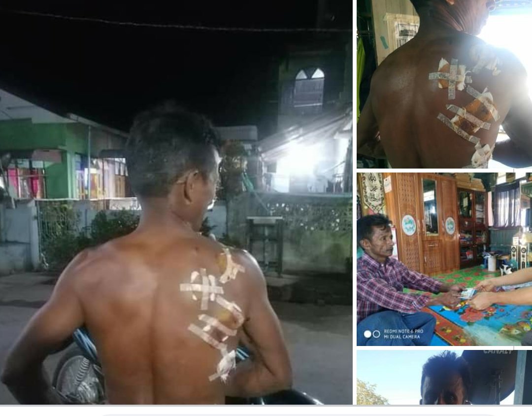 Kathpunzel06's tweet image. Soe Win, the hero who was hit by rubber bullets  to protect the students in Mawlamyine, is an Islam. If you believe in religious extremism again, please think these things.
#savemyanmar
#stopreligiousdiscrimination
#WhatHappeningInMyanmar